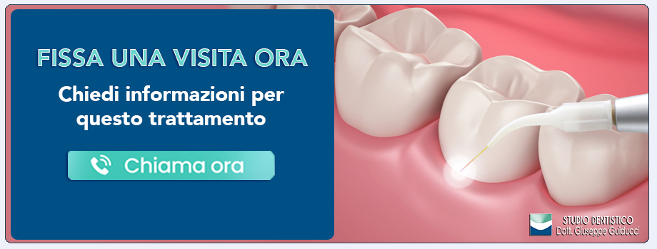 cura-della-parodontite-con-il-laser Pescara