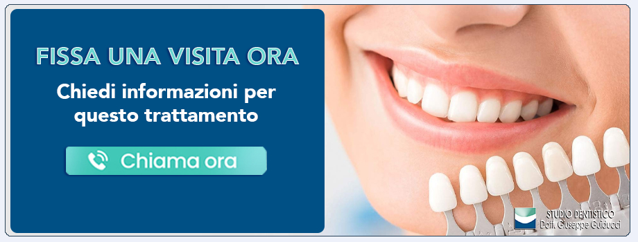 faccette-estetiche-dentali Pescara
