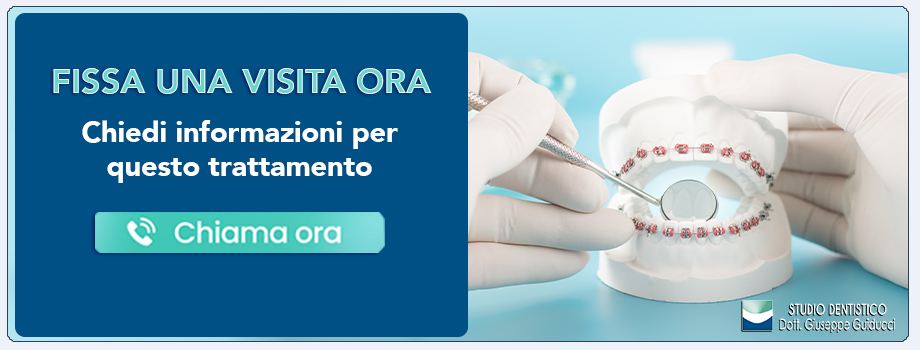 ortodonzia-convenzionale Pescara